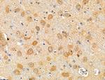 Phospho-Catenin alpha-1 (Ser655, Thr658) Antibody in Immunohistochemistry (Paraffin) (IHC (P))