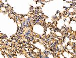 Phospho-Caspase 8 (Tyr380) Antibody in Immunohistochemistry (Paraffin) (IHC (P))