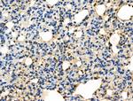 Phospho-Caspase 8 (Tyr380) Antibody in Immunohistochemistry (Paraffin) (IHC (P))