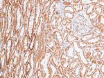 Phospho-Chk2 (Ser33, Ser35) Antibody in Immunohistochemistry (Paraffin) (IHC (P))