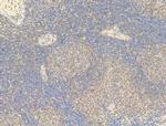 Phospho-C-Jun (Ser73) Antibody in Immunohistochemistry (Paraffin) (IHC (P))