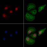 Phospho-DNMT1 (Ser714) Antibody in Immunocytochemistry (ICC/IF)