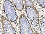 Phospho-DNMT1 (Ser714) Antibody in Immunohistochemistry (Paraffin) (IHC (P))