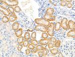 Phospho-EIF4B (Ser504) Antibody in Immunohistochemistry (Paraffin) (IHC (P))