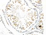 Phospho-EIF4B (Ser504) Antibody in Immunohistochemistry (Paraffin) (IHC (P))