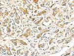 Phospho-EPRS (Ser886) Antibody in Immunohistochemistry (Paraffin) (IHC (P))