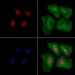 Phospho-EZH2 (Thr345) Antibody in Immunocytochemistry (ICC/IF)