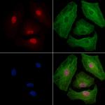 Phospho-EZH2 (Thr345) Antibody in Immunocytochemistry (ICC/IF)