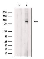 Phospho-HGS (Tyr216) Antibody in Western Blot (WB)
