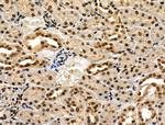 Phospho-IRF7 (Ser471, Ser472) Antibody in Immunohistochemistry (Paraffin) (IHC (P))