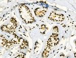 Phospho-JAK2 (Tyr1008) Antibody in Immunohistochemistry (Paraffin) (IHC (P))