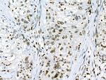 Phospho-JAK2 (Tyr1008) Antibody in Immunohistochemistry (Paraffin) (IHC (P))