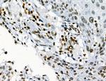 Phospho-JAK2 (Tyr1008) Antibody in Immunohistochemistry (Paraffin) (IHC (P))