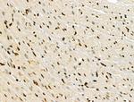 Phospho-JAK2 (Tyr1008) Antibody in Immunohistochemistry (Paraffin) (IHC (P))