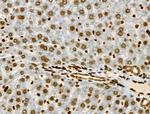 Phospho-JAK2 (Tyr1008) Antibody in Immunohistochemistry (Paraffin) (IHC (P))