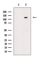 Phospho-JAK2 (Tyr1008) Antibody in Western Blot (WB)