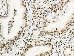 Phospho-JIP1 (Thr205) Antibody in Immunohistochemistry (Paraffin) (IHC (P))