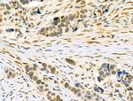 Phospho-Lamin A/C (Ser390) Antibody in Immunohistochemistry (Paraffin) (IHC (P))