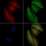 Phospho-LRRK2 (Ser935) Antibody in Immunocytochemistry (ICC/IF)