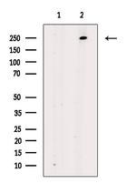 Phospho-LRRK2 (Ser935) Antibody in Western Blot (WB)