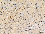 Phospho-MEK3/MEK6 (Ser189, Thr193) Antibody in Immunohistochemistry (Paraffin) (IHC (P))