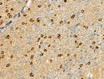 Phospho-MEK7 (Ser271) Antibody in Immunohistochemistry (Paraffin) (IHC (P))