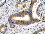 Phospho-MEK7 (Thr275) Antibody in Immunohistochemistry (Paraffin) (IHC (P))