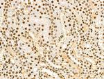 Phospho-NPM1 (Ser125) Antibody in Immunohistochemistry (Paraffin) (IHC (P))