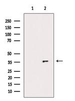 Phospho-NPM1 (Ser125) Antibody in Western Blot (WB)