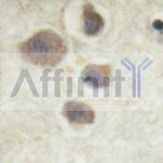 Phospho-p70 S6 Kinase (Thr252) Antibody in Immunohistochemistry (Paraffin) (IHC (P))