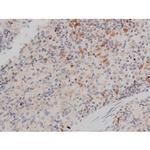 Phospho-p70 S6 Kinase (Thr252) Antibody in Immunohistochemistry (Paraffin) (IHC (P))