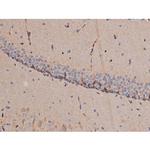 Phospho-p70 S6 Kinase (Thr252) Antibody in Immunohistochemistry (Paraffin) (IHC (P))