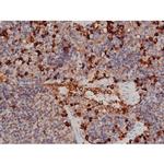 Phospho-p70 S6 Kinase (Thr252) Antibody in Immunohistochemistry (Paraffin) (IHC (P))