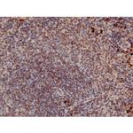 Phospho-p70 S6 Kinase (Thr252) Antibody in Immunohistochemistry (Paraffin) (IHC (P))