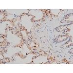 Phospho-p70 S6 Kinase (Thr252) Antibody in Immunohistochemistry (Paraffin) (IHC (P))