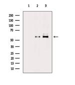 Phospho-PFKFB3 (Ser461) Antibody in Western Blot (WB)