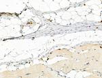 Phospho-PFKFB3 (Ser461) Antibody in Immunohistochemistry (Paraffin) (IHC (P))