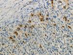 Phospho-PFKFB3 (Ser461) Antibody in Immunohistochemistry (Paraffin) (IHC (P))