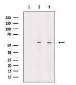 Phospho-PFKFB3 (Ser461) Antibody in Western Blot (WB)