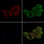 Phospho-Phospholamban (Ser16, Thr17) Antibody in Immunocytochemistry (ICC/IF)