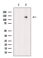 Phospho-PKC mu (Ser910) Antibody in Western Blot (WB)