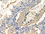 Phospho-PP1 alpha (Thr320) Antibody in Immunohistochemistry (Paraffin) (IHC (P))