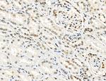 Phospho-Progesterone Receptor (Ser190) Antibody in Immunohistochemistry (Paraffin) (IHC (P))