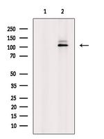 Phospho-PYGL (Ser15) Antibody in Western Blot (WB)