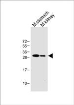 PSCA Antibody in Western Blot (WB)