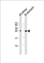 PSCA Antibody in Western Blot (WB)