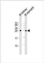 PSCA Antibody in Western Blot (WB)