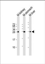 PSCA Antibody in Western Blot (WB)