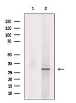 Phospho-RAB29 (Ser72) Antibody in Western Blot (WB)