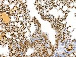 Phospho-RSK Pan (Ser221, Ser227, Ser218, Ser232) Antibody in Immunohistochemistry (Paraffin) (IHC (P))